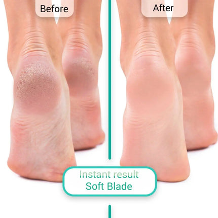 Espuma suavizante exprés para pedicura Soft Blade Shelly 150 ml